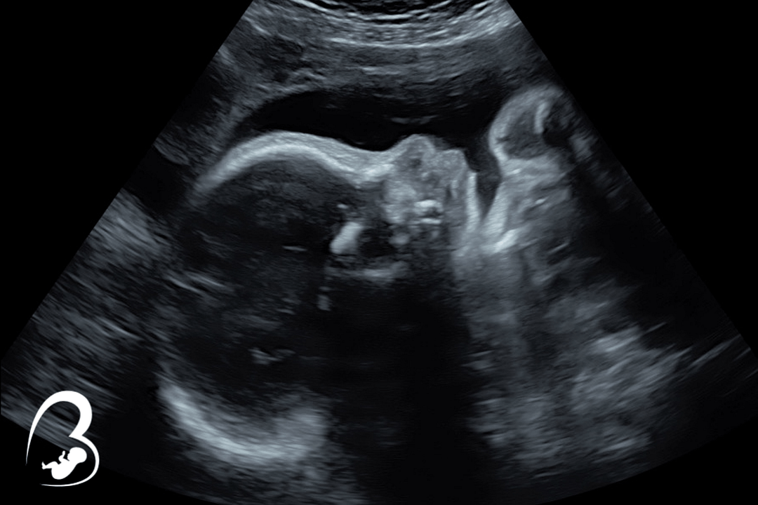 Bella Bambinos Boutique & Imaging, Fairfield County's Premier 3D 4D HD Live Ultrasound Facility - Checking In Session